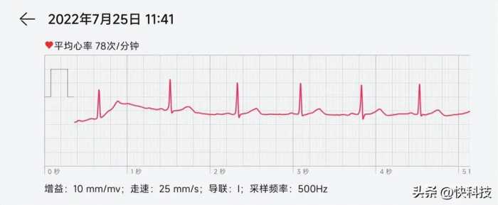 ECG 30秒发现心脏异常！华为WATCH 3 Pro new评测