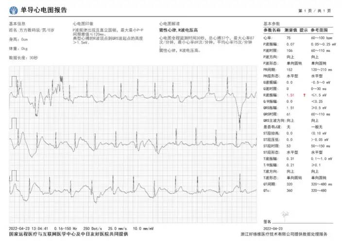 华为WATCH GT 3 Pro系列上手测评：智能手表新突破，运动 健康全监测