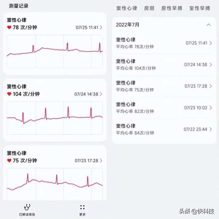 ECG 30秒发现心脏异常！华为WATCH 3 Pro new评测