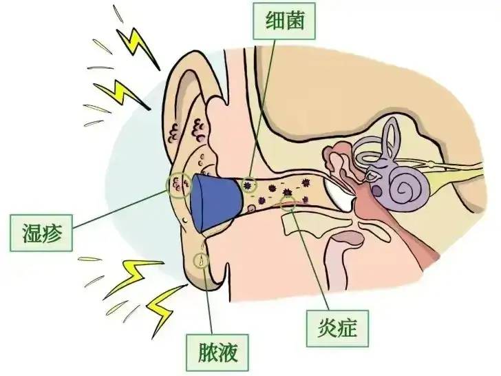 耳机天天戴，危害你知道吗？