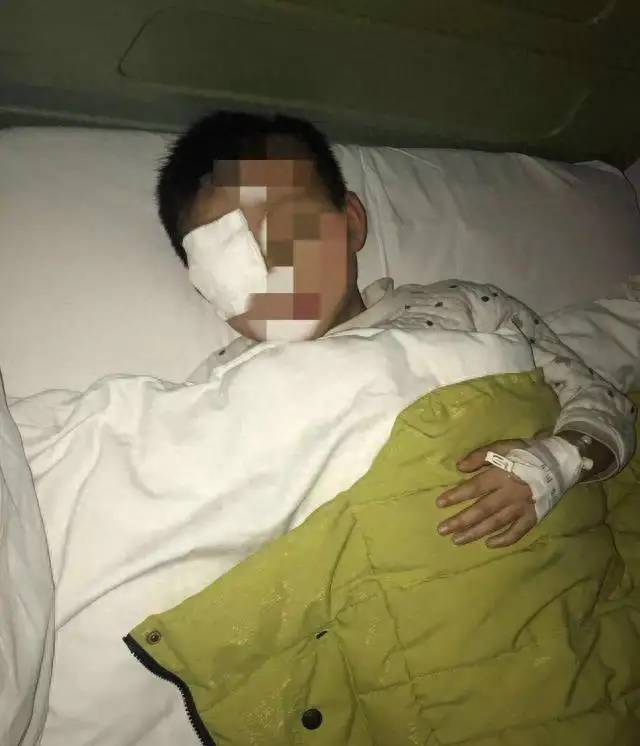 20分钟男孩眼珠被“熔化”，这东西每家都有，家长一定要高度警惕